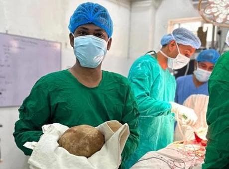 Sri Lanka'da tıp tarihine geçen operasyon: Hastanın mesanesinden 3.1 kiloluk taş çıkarıldı